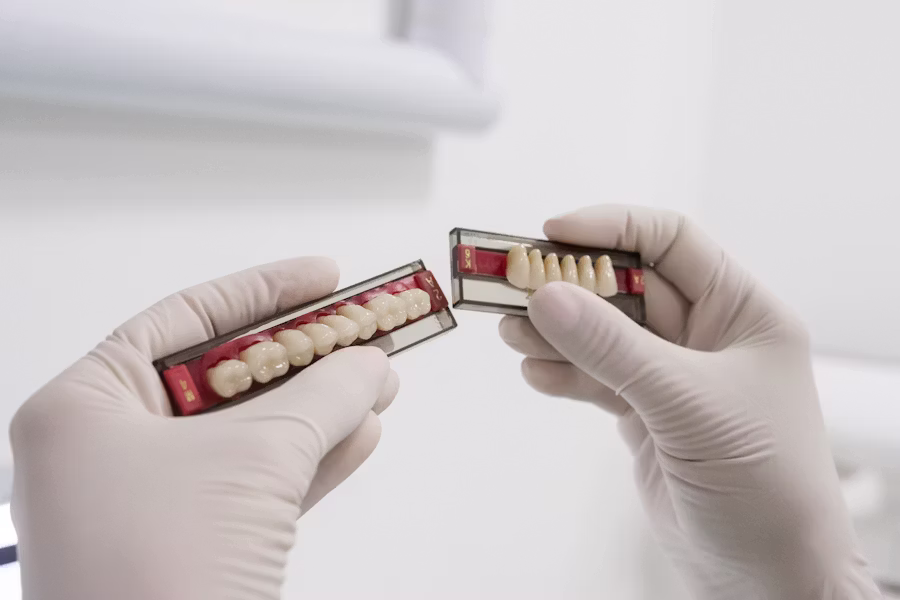 Cura dell'impianto dentale — Studio Dentistico Cadore-Setti