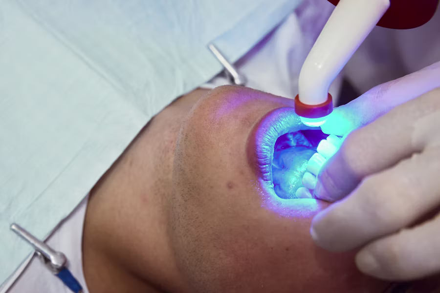 Sbiancamento denti professionale in studio — Studio Dentistico Cadore-Setti