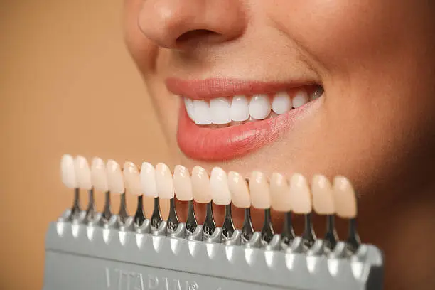 Sorriso perfetto con trattamenti di estetica dentale — Studio Dentistico Cadore-Setti